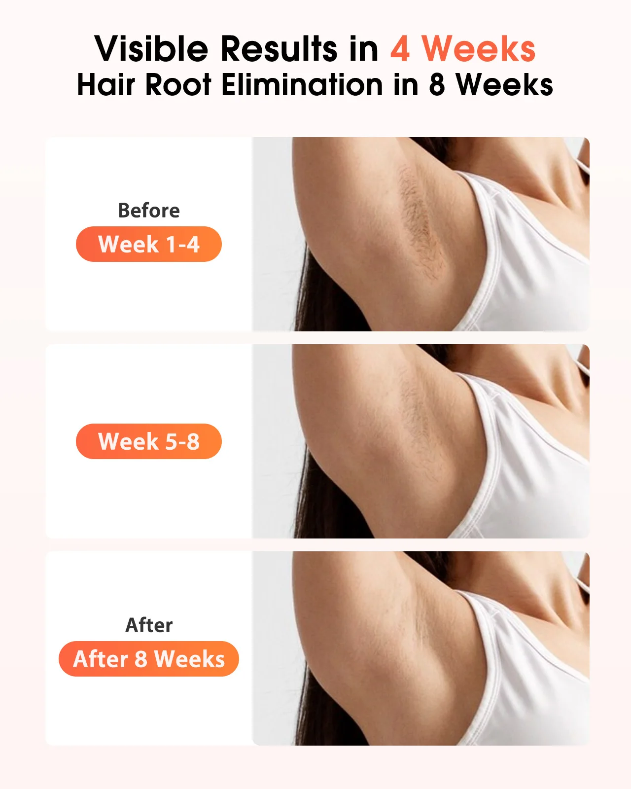 Thumbnail 3 - #7 Best IPL Devices to Buy In 2026