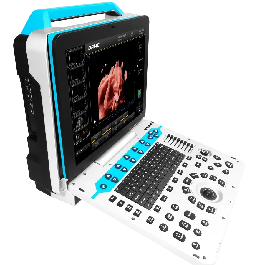 HD 4d5d portable OB GYN color Doppler ultrasound medical machine