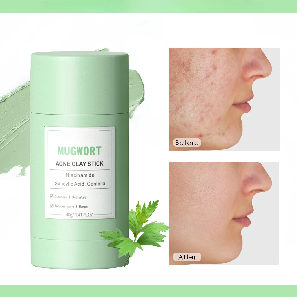 Mugwort Mud Mask Stick cleanses and improves acne skin Deep cleaning Hydrate and moisturize Skin care