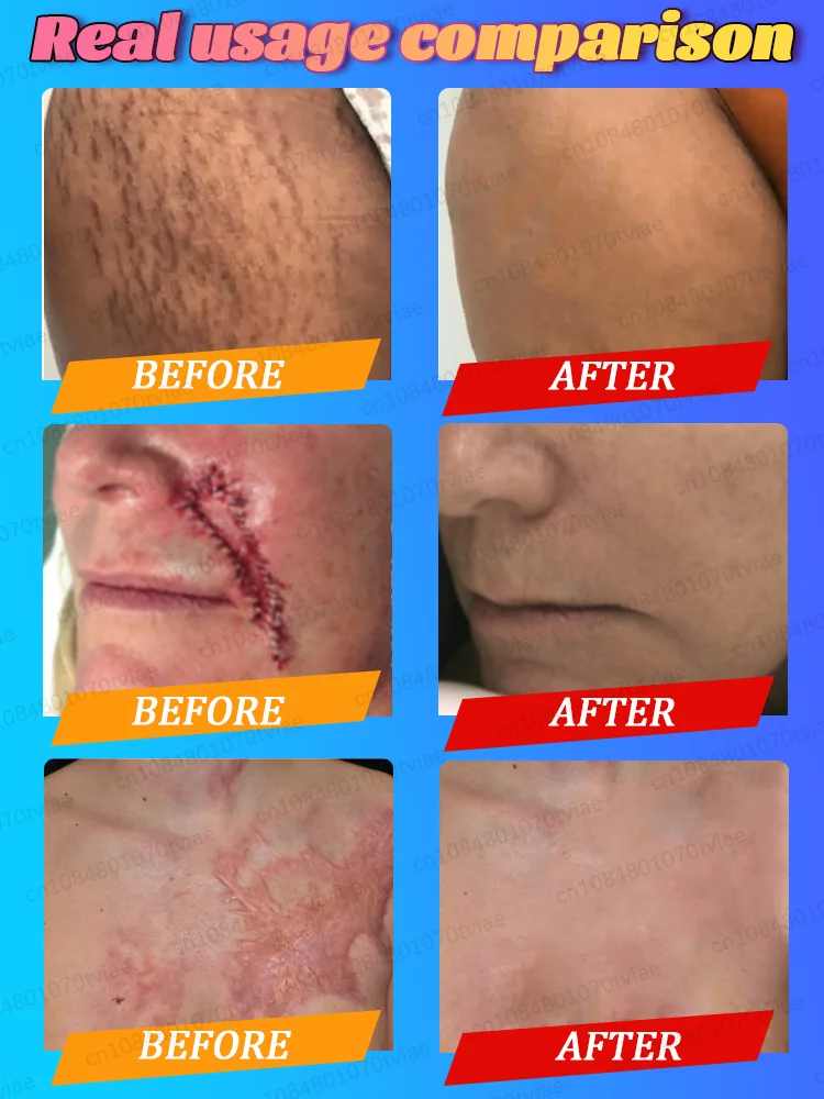 Zorg voor je littekens en laat het ze helpen oplossen