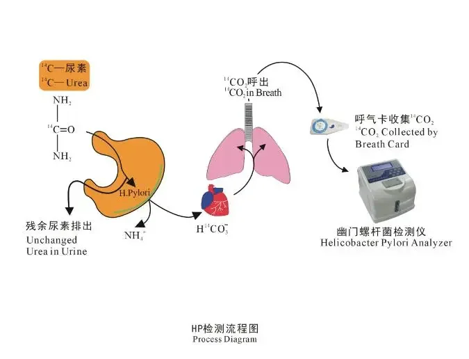 Helicobacter pylori detector c14 carbon 14 tester c13 carbon 13 examination test breath card breath test