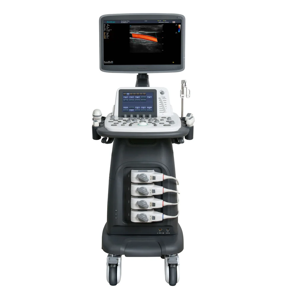 Sonoscape S22 Mobile 3D/4D High Resolution Touch Screen Color Doppler Trolley Ultrasound Machine