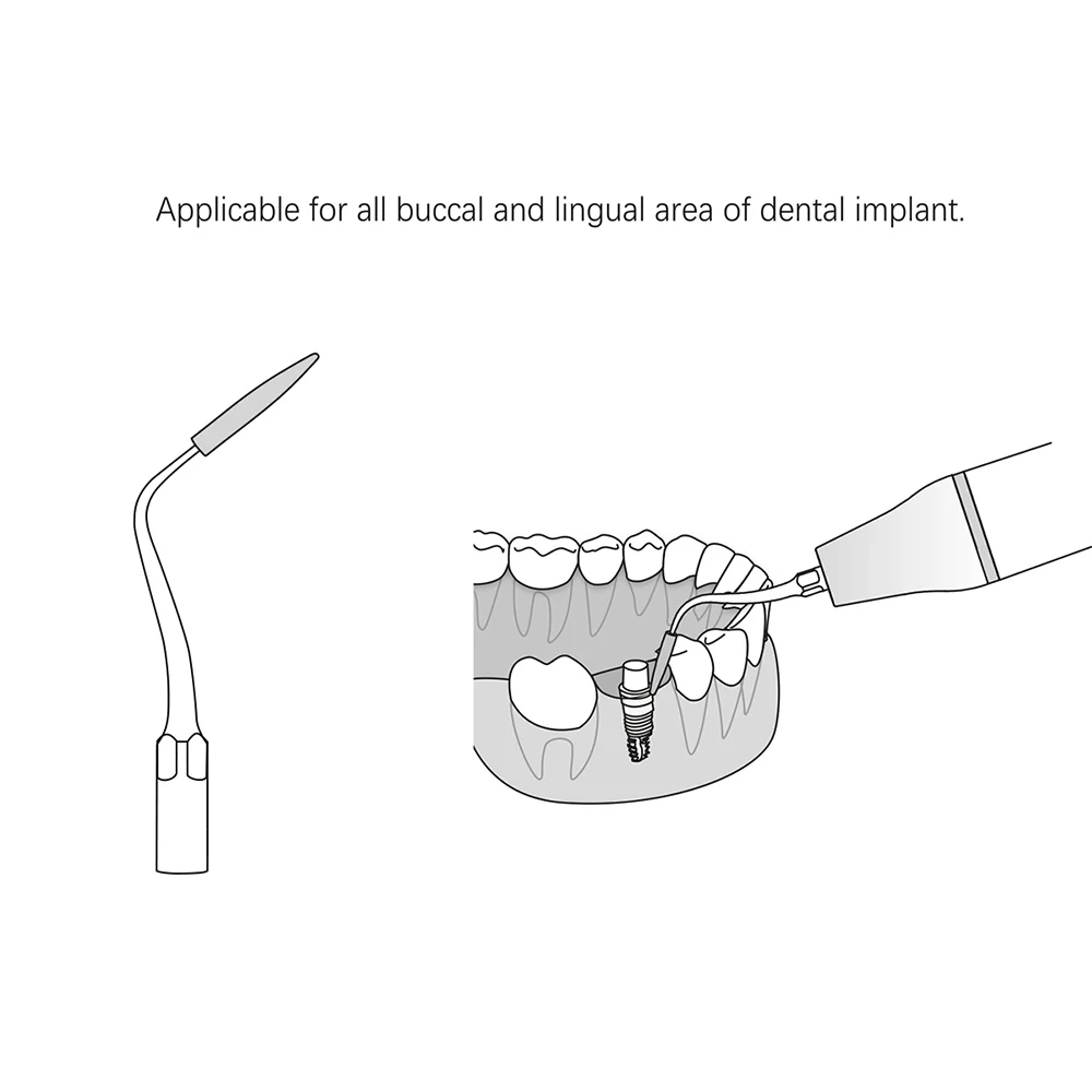 1 PC skaler dentystyczny końcówka do czyszczenia implantów przyzębia pasuje do rękojeści ultradźwiękowej Dental