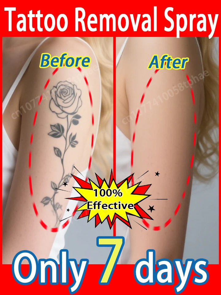 

Tᴀᴛᴛᴏᴏ Rᴇᴍᴏᴠᴀʟ Sᴘʀᴀʏ ,Gᴇɴᴛʟᴇ Mɪsᴛ,Fᴀᴅᴇs Fᴀsᴛ Wɪᴛʜᴏᴜᴛ Sᴛɪɴɢ,2025 Sɪᴍᴘʟᴇ Sᴏʟᴜᴛɪᴏɴ