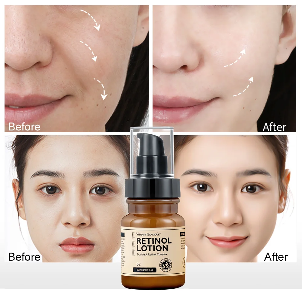 VIBRANTGLAMOUR Retinol Face Lotion Cream Anti-Aging Remove Wrinkle Firming Lifting Whitening Brightening Moisturizing Skin Care