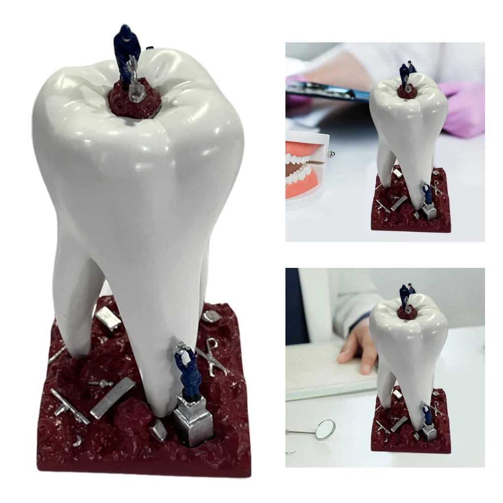 Resin Surprise Gift For Dentists - Cute Figurine To Decorate Dental Clinics Add Of Fun And Surprise Decoration