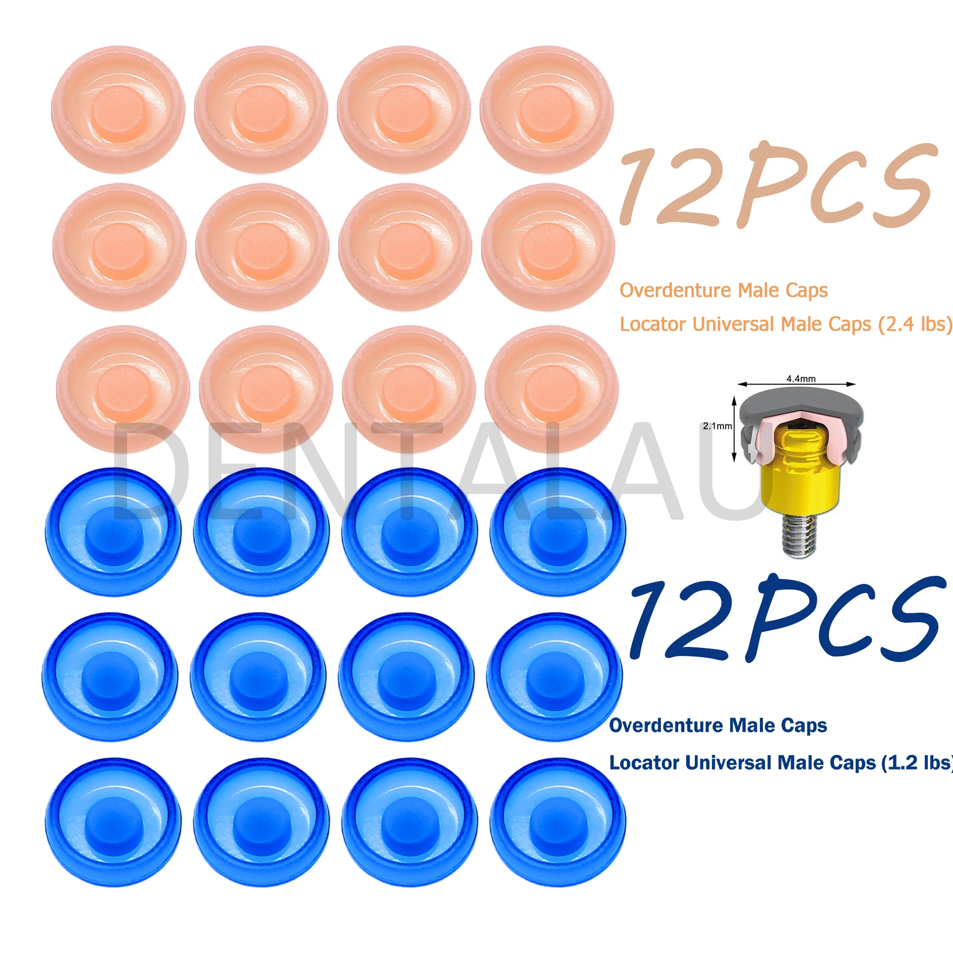 

Dental Overdenture Locator Abutments Retention Caps For Implant Inserts 1.2lbs/2.4lbs Removable Universal