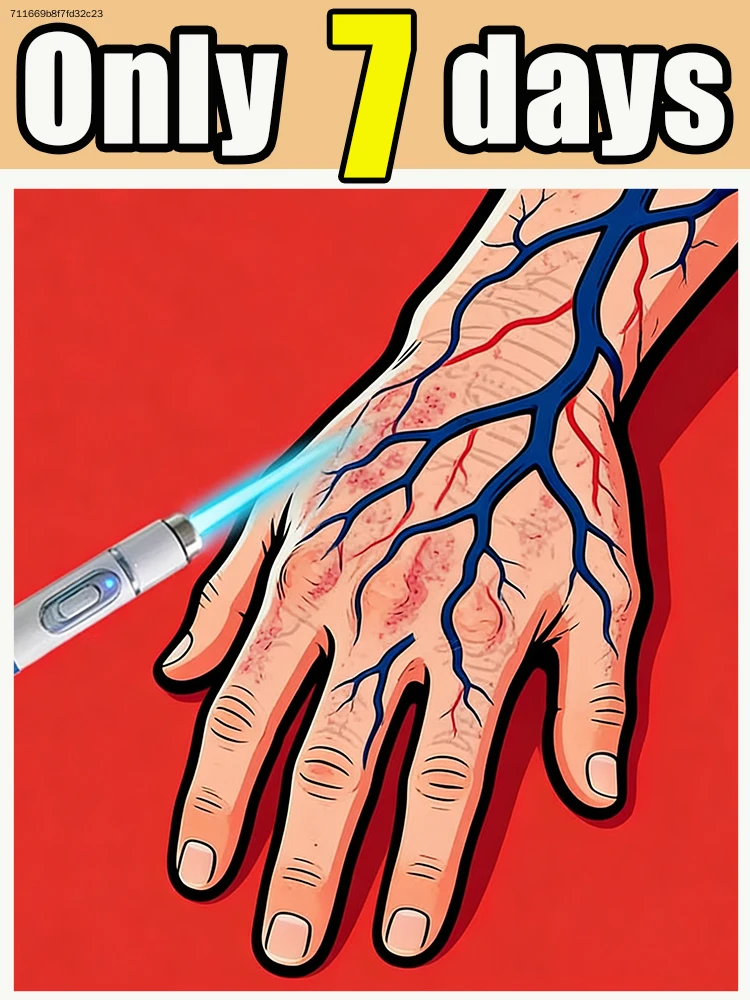 

Help people with prominent veins in their legs, feet, and arms