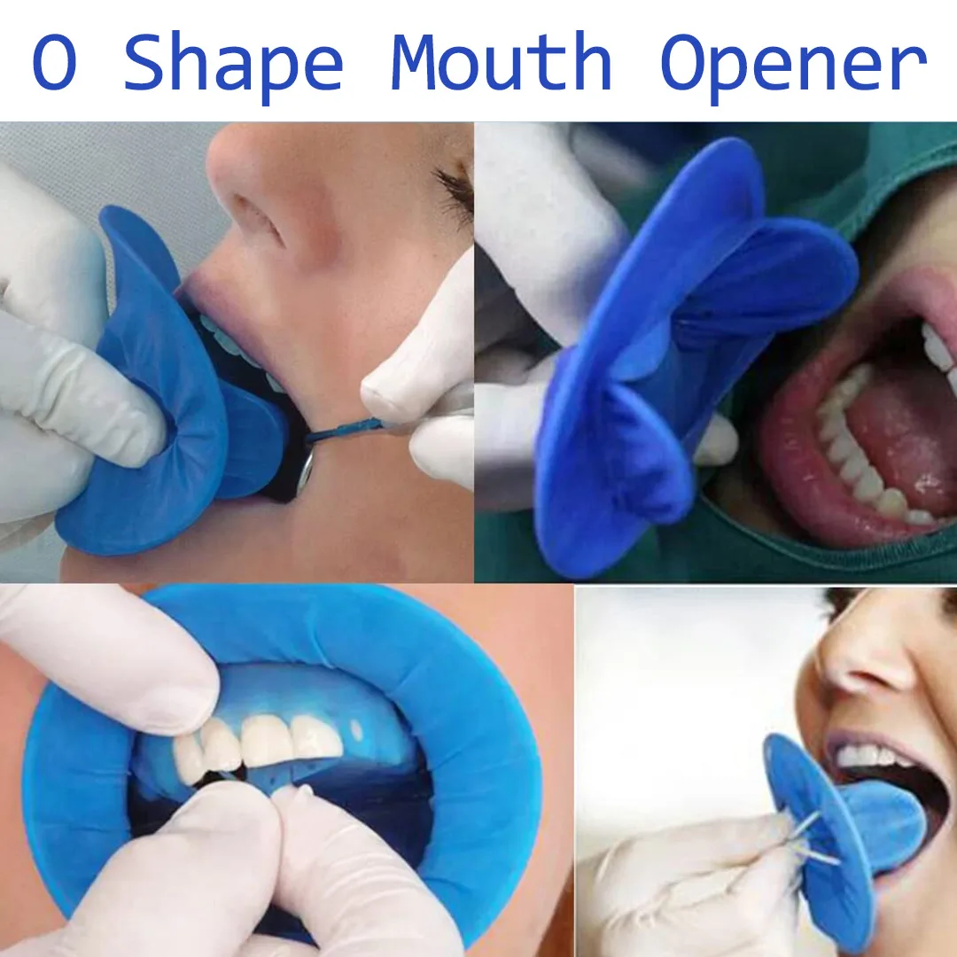 10/20pcs Dental O Shape Disposable Rubber Dam Sterile Mouth Opener Oral Cheek Expand Cheek Retractor Opener for Oral Safe Clamps