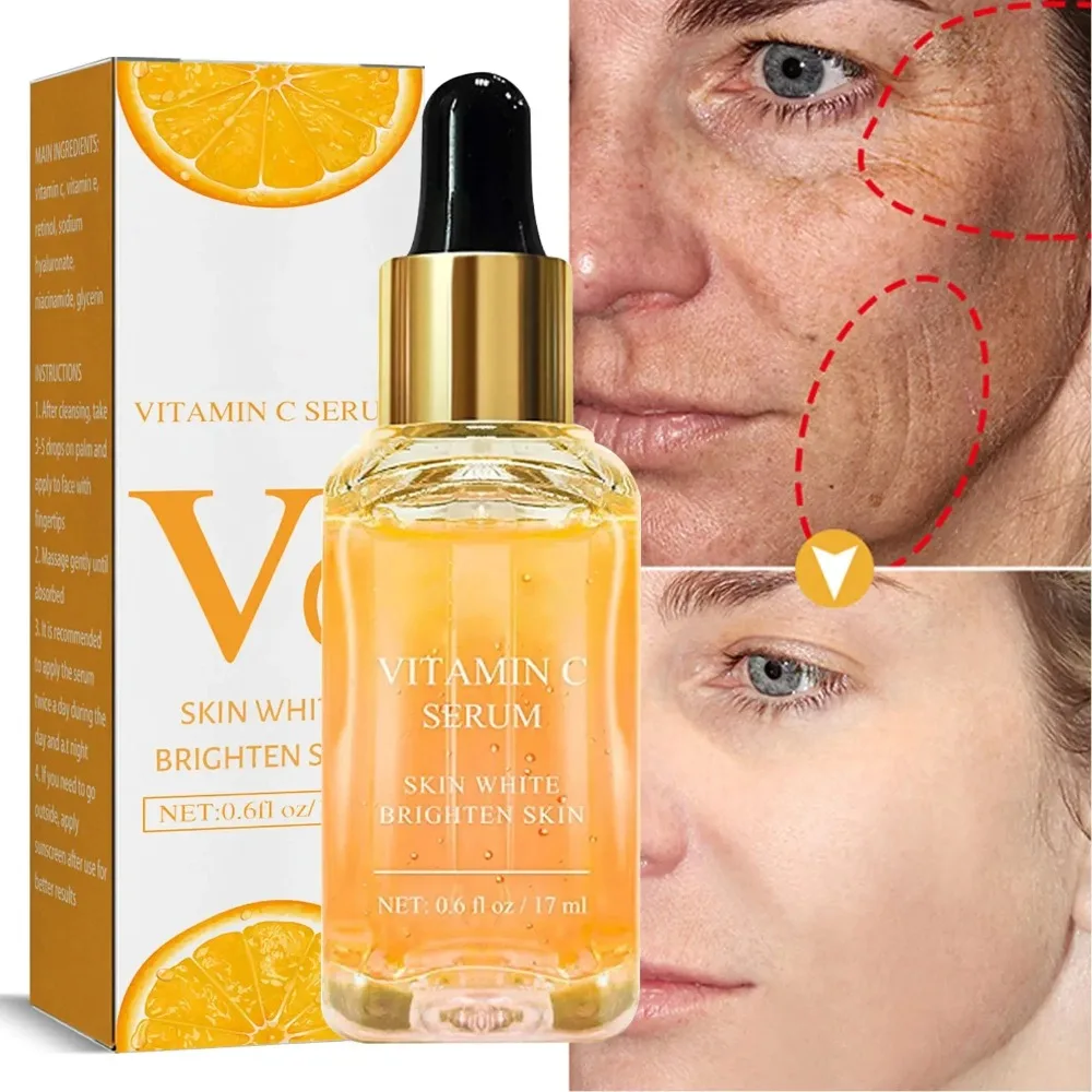 Entfernen Sie dunkle Flecken, aufhellendes Gesichtsserum, Retinol, aufhellendes Vitamin-C-Serum, Sommersprossen, verblassen Sie Melanin, Anti-Falten-Essenz-Haut