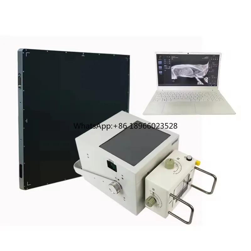 5.3kw Mobile Digital human Xray Machine Dr Radiography Xray Machine Equipment Portable X-Ray Machine