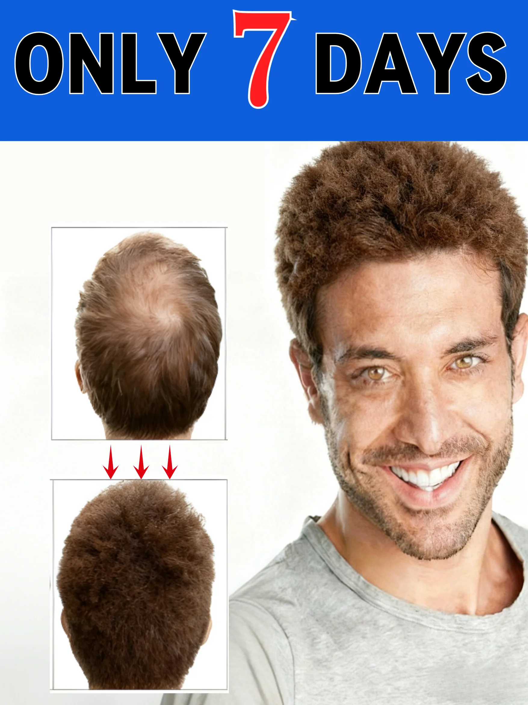 

Сыворотка для роста волос, масляная комбинация, аппликатор для кожи головы, жидкая расческа для лечения кожи головы, устройство для сторонних волос