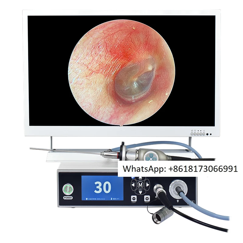

Ear, Nose, Throat Video Light Source Integrated Machine/Ear Picking Pet Endoscope Integrated Machine