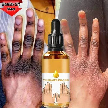 Suero iluminador rápido para nudillos oscuros, codos, suero iluminador para nudillos de mano, rodilla, piel negra, aclara rápidamente la esencia eliminadora de manchas