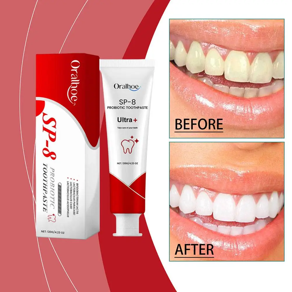 Respiração fresca creme dental triplo, SP-8 Creme dental branqueador, Gestão de Saúde Oral, Profundo produto probiótico, 120g