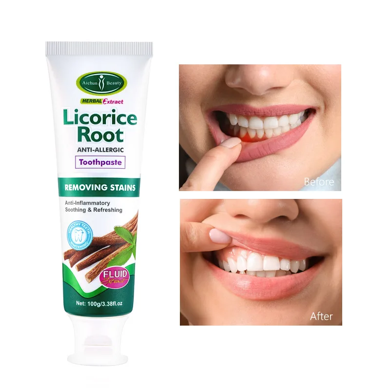 

Licorice Root Anti-Allergic Toothpaste Whitening Brighten Removes Stains Freshen Breath Maintain Oral Health Dental 100g