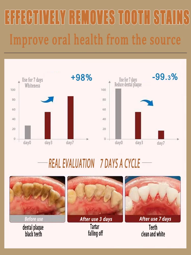 حار بيع معدل إعادة الشراء بنسبة 98% قل وداعاً لجميع مشاكل طب الأسنان