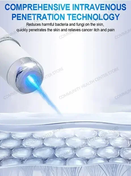 Vena laser |   esercizi sulle vene |   trainer delle vene |   esercizi per le mani delle vene