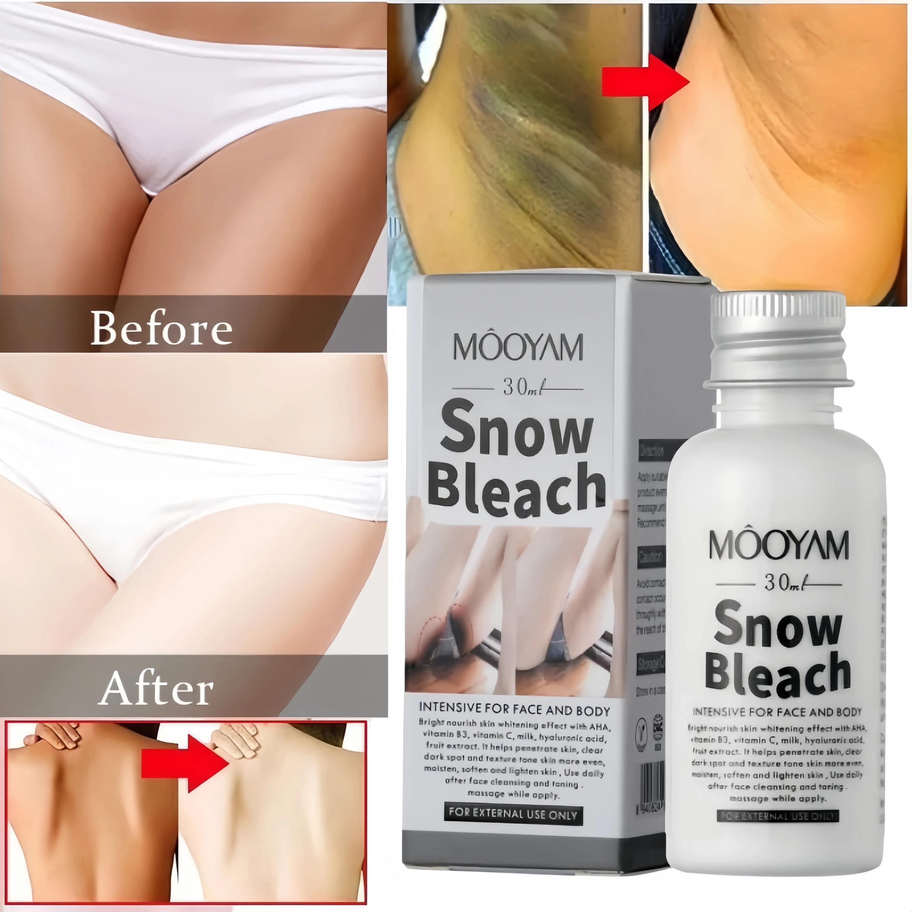 Body Whitening Cream Remove Thigh Inner Joint Dark Melanin Knee Bleach Private Part Whiten Lighten Moisturize Brighten Body Care