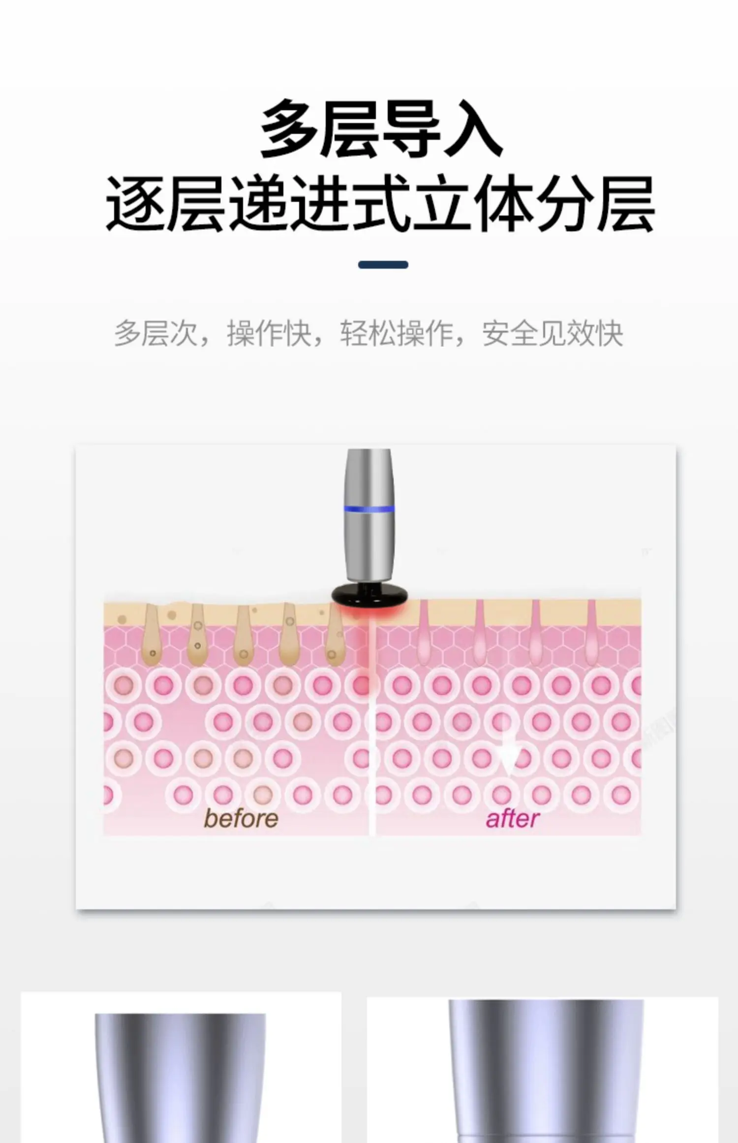 Strumento di bellezza Hot Lift Face Tightening Law Collo Rughe Introduzione Frequenza V Viso Occhio Periferico Domestico