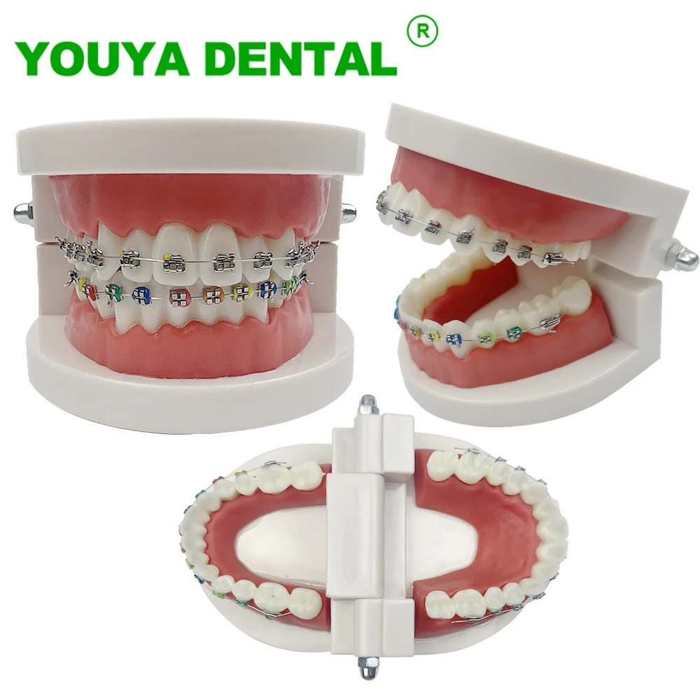 Dental Orthodontic Model With Self Ligating Metal Bracket Arch Wire Typodont Teeth Treatment Model Dentist Demonstration Tools