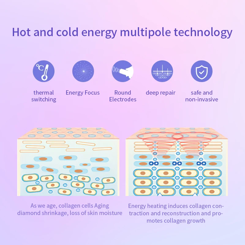 معدات تبريد البشرة، جهاز تجميل الوجه بالتبريد الكهربائي، الدورة الليمفاوية، إزالة اصفرار، جهاز رفع الوجه #4