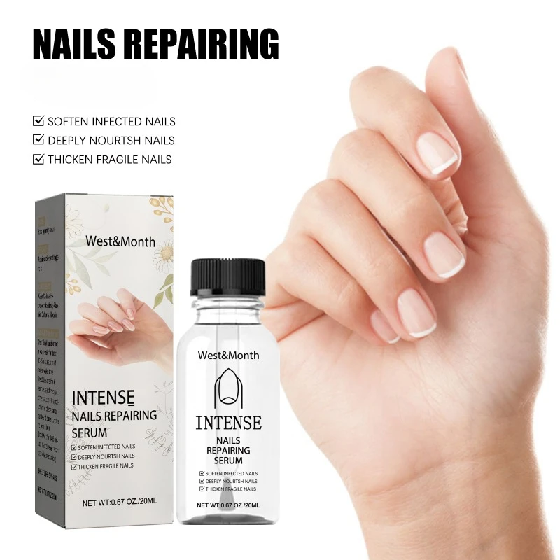 Nail repair essence Fungus Treatment onychomycosis hand care feet fungal removal soft nails thickening brighten Anti infective