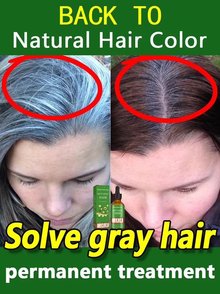 

Anti Gray Hair Remedy Serum Treatment of white hair