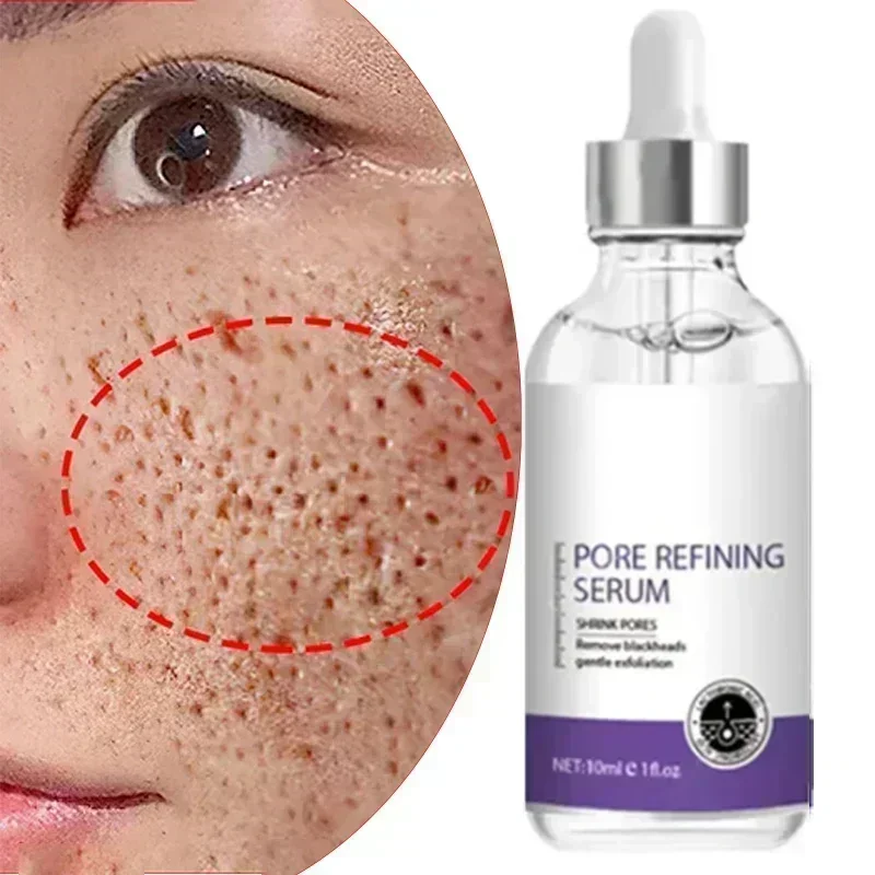 Eliminate Large Pores Facial Essence Firming and Rejuvenating Fine Pores Repair Whitening Brightening