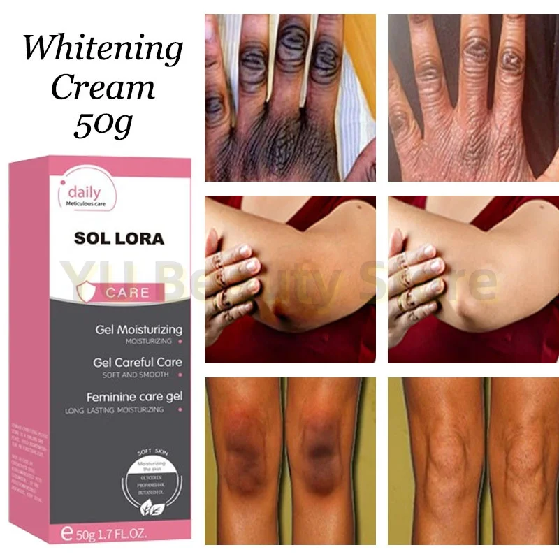 

Inner Thigh Brighten Cream Bleaching Armpits Elbows Knees Moisturizing Body Lotion Cream Brighten Lightening Melanin Skin Cream