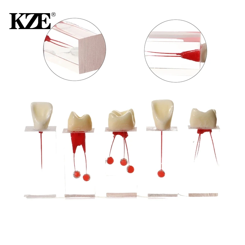 Dental RCT Endo Teeth Model Endodontic Root Canal Block Pulp Cavity Resin Study Practice Endodontic Training