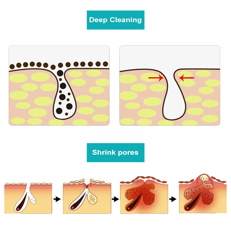 Naso Comedone Uscita Liquido Pulizia Profonda Cura Della Pelle Cura Della Pelle Restringimento Dei Pori Trattamento Dell'acne Maschera Macula Spot Pore Cleaner 400ml