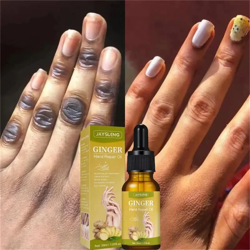 

Dark Knuckles Fast Whitening Serum Brightening Pigmentation Correctors For Black Skin Intense Stains Remover Essence Products