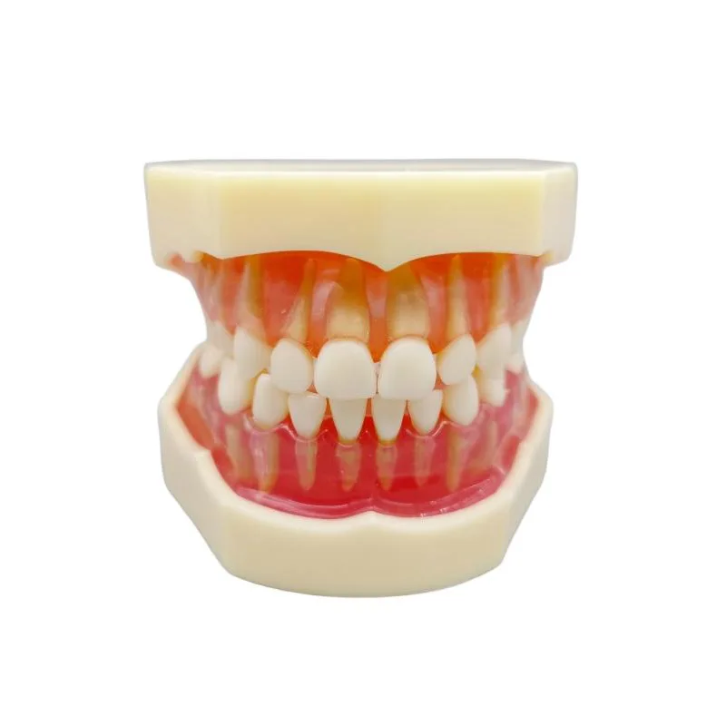 

Full Mouth Removable Model 20pcs Baby Teeth Resin Model Soft Gum Milk Teeth for Medical Science Practice Teaching