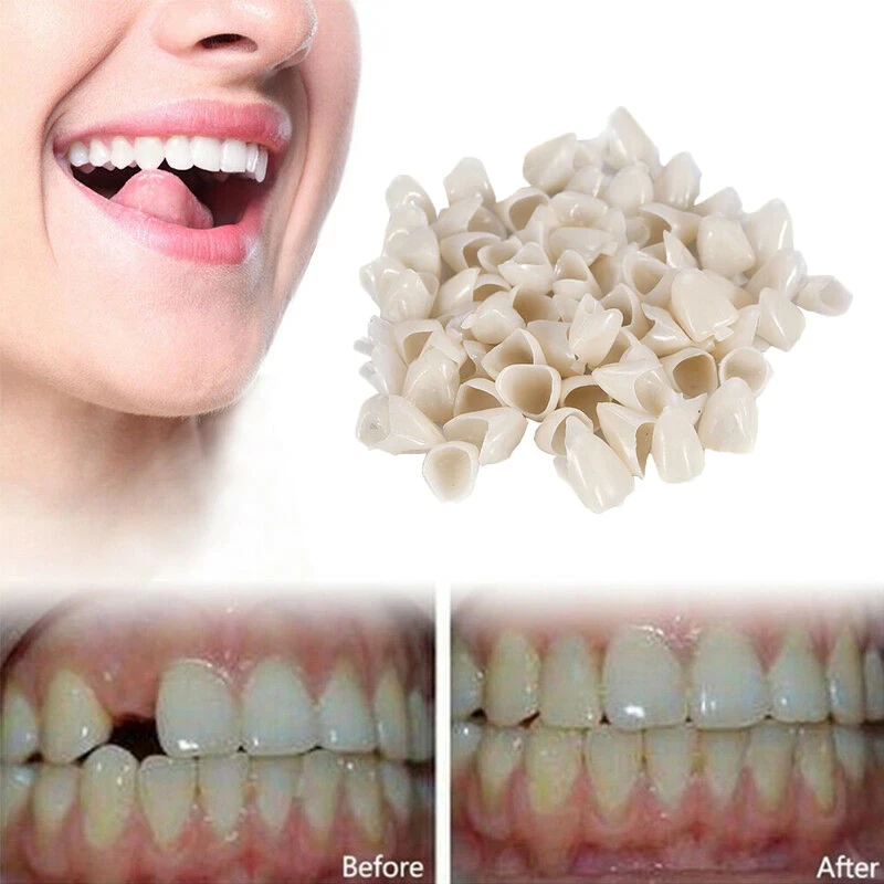 1 Box Crowns Posteriors Anterior Molar Front/Back Tooth Teeth Caps Dental False Teeth Cover Removable Teeth Veneers