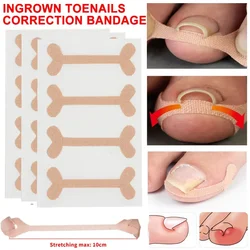 Ingrown Toenail Corrector Sticker Nail Strip Anti-roll Nail Free Glue Toe Inlay Nail Corrector Patch Correction Stickers Toenail