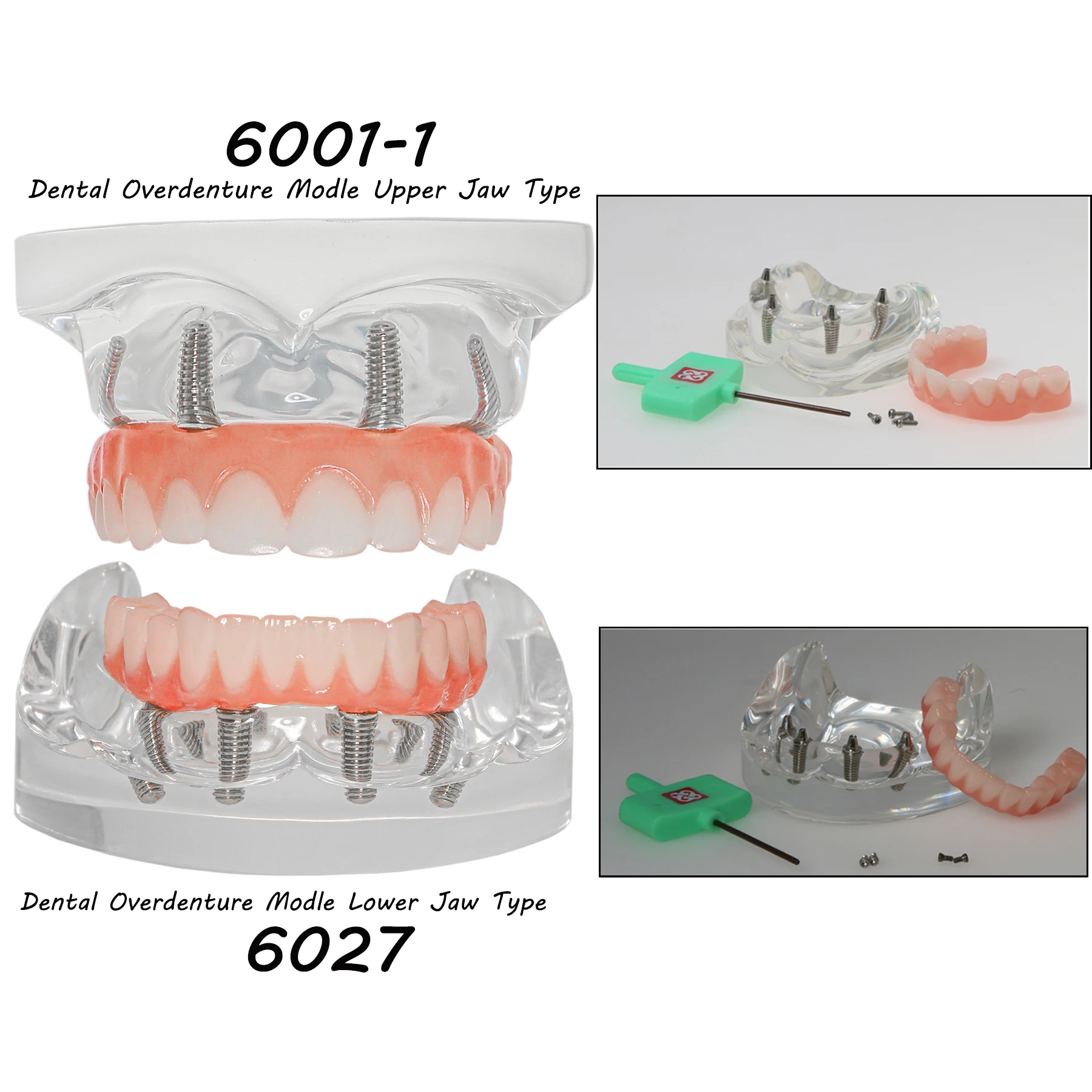 

Dental Implant Teeth Model Transparent Upper/Lower Jaw Type All on 4 Overdenture Modle with 4 Removable Screws Study Model Demo