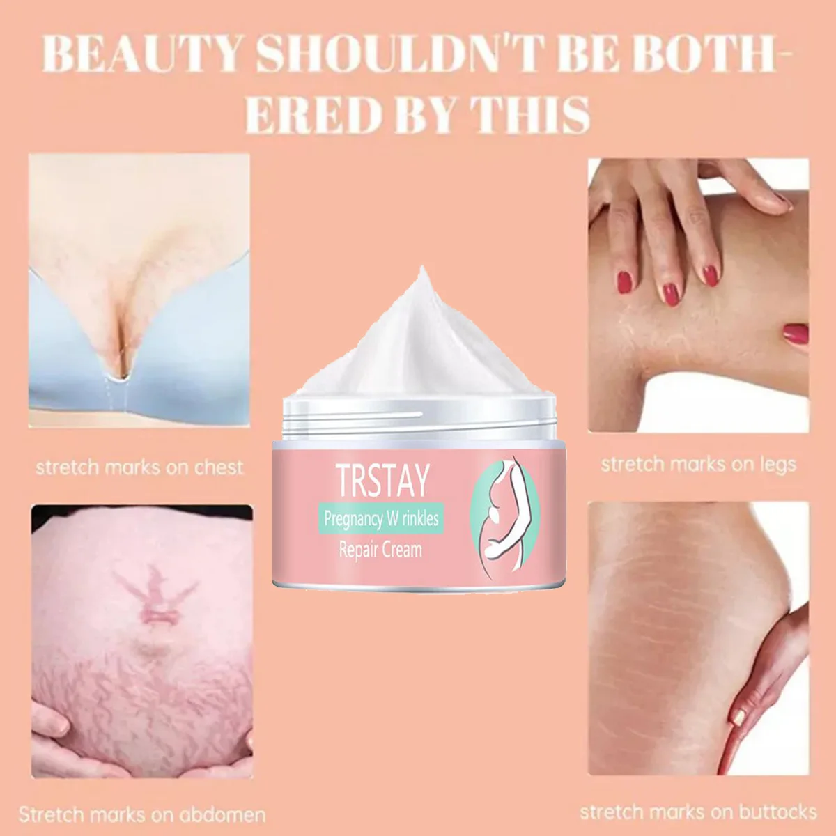 TRSTAY crème réparatrice pour la grossesse soins de la peau élasticité humidité collagène vergetures et cicatrices fondues pendant la maternité