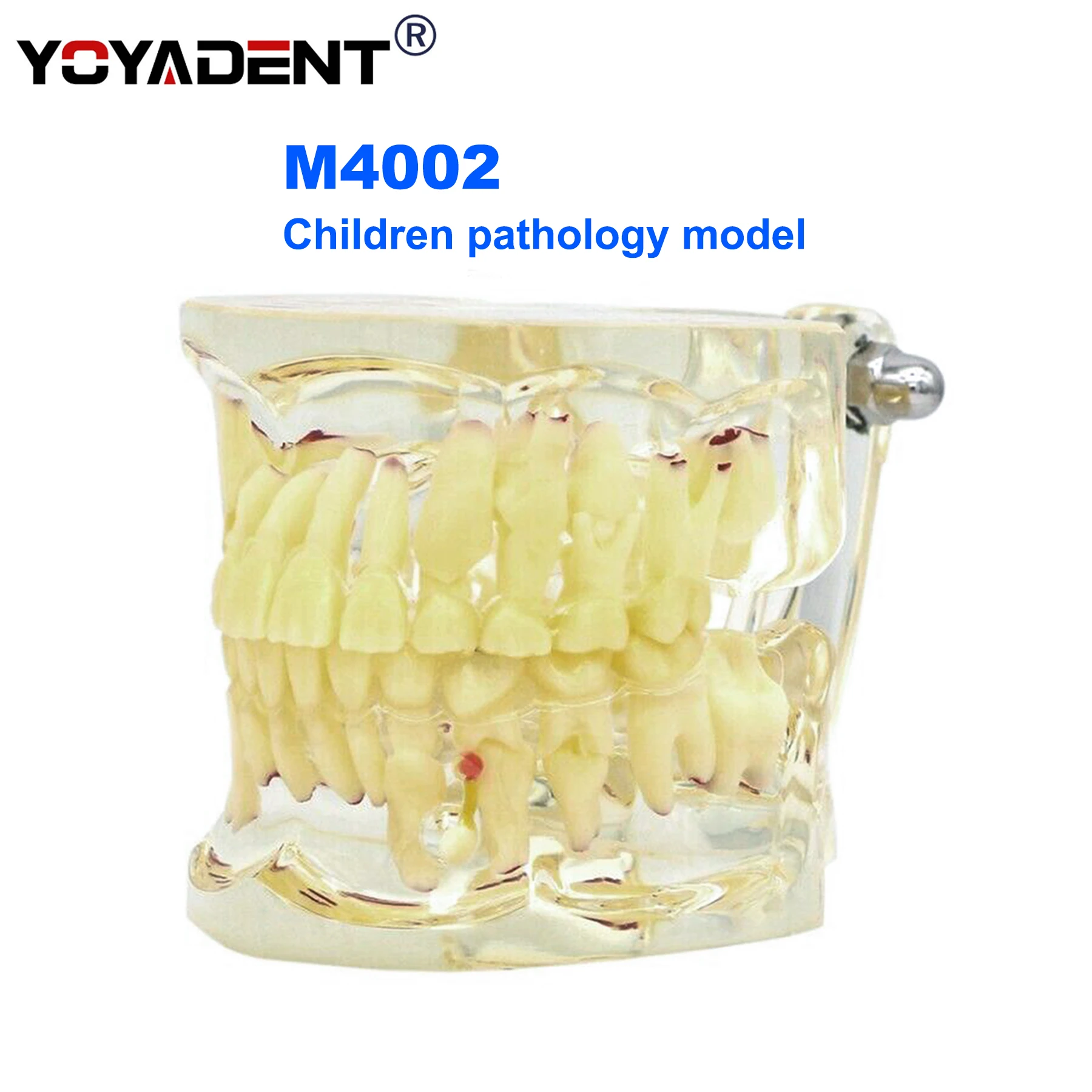 Dental Teeth Model pathology Model molar dental education Demo Model