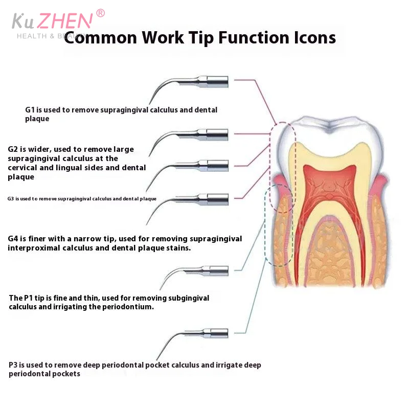 

Стоматологические ультразвуковые насадки для удаления перио, инструменты для стоматолога, эндодонтия корневых каналов, серия E, подходят для EMS UDS, наконечник для скалера для корневых каналов