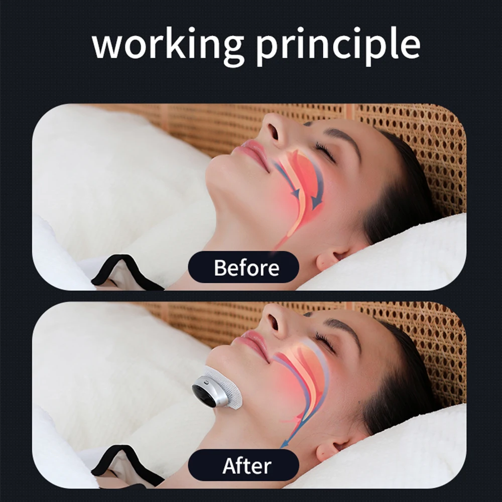 Electric Anti-snoring Device Breathing Corrector Electric Anti Snoring Sleep Pro EMS Anti Snoring Device For Home Travel