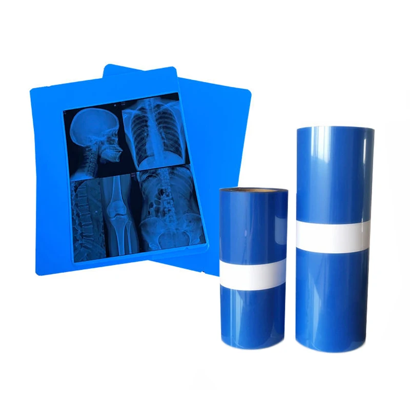 

Medical Equipment Dry Inkjet Digital Xray Films Size 10 X 12 Inches