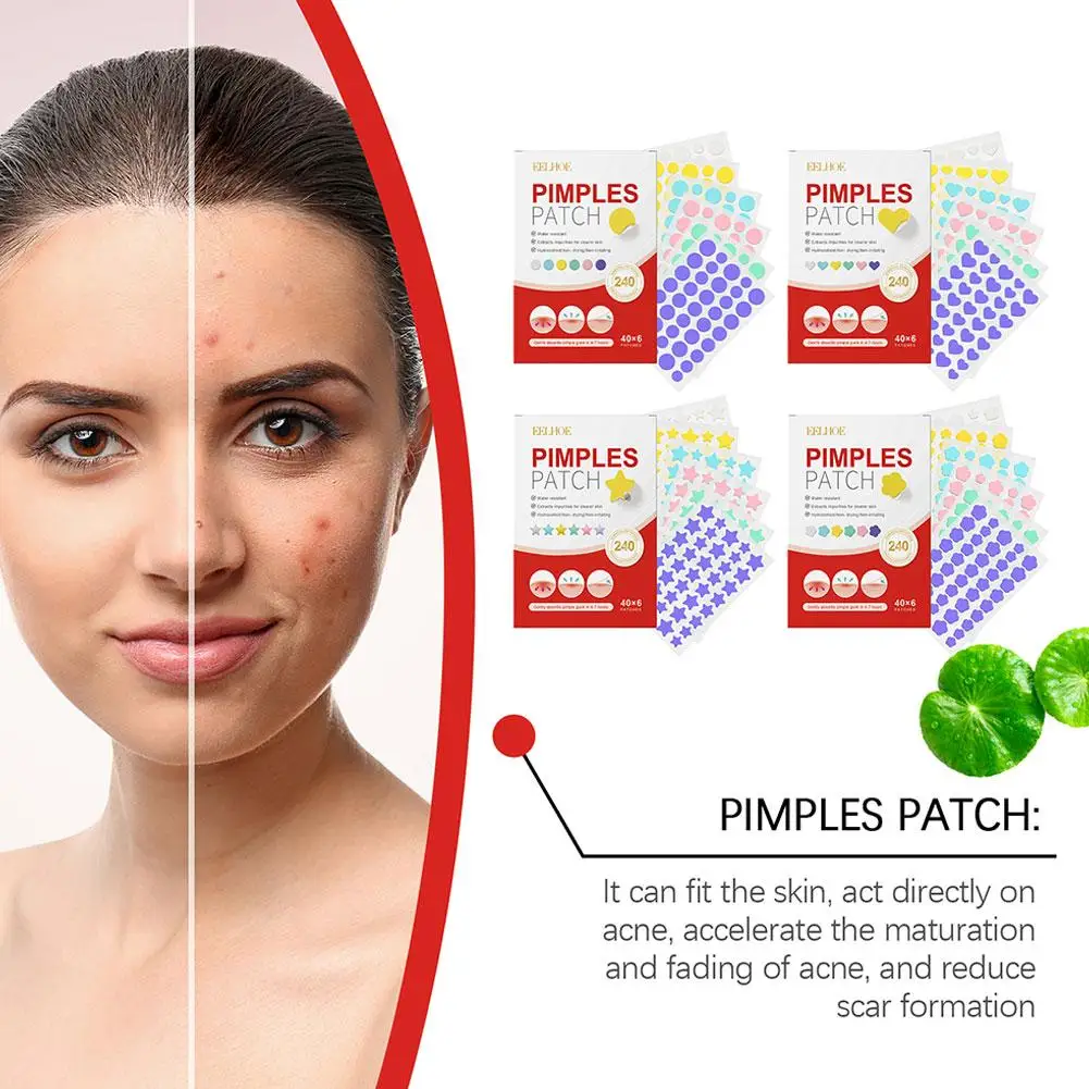 240 Stuks Salicylzuur Acne Patch Puistje Behandeling Gezicht Roodheid Reparatie Voor Puistjes Puistjes Huidverzorging Acne Verwijdering Stickers Masker