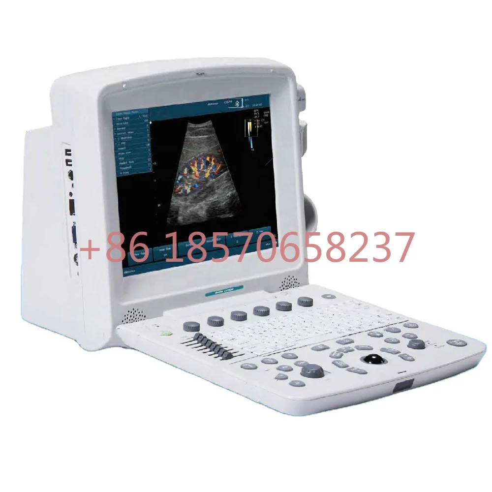 EDAN U50 Scanner Machine ecografo ultrasonido Laptop Color Doppler portable ultrasound price