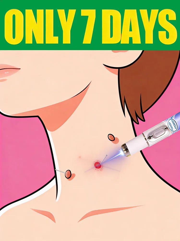 2025 New Blue Light Wart Removal Device: Fast Wart Removal, Special Offers for Buying a Set