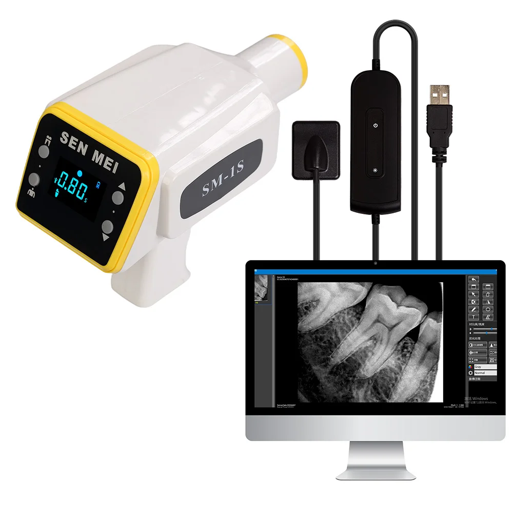 

Портативный стоматологический рентгеновский аппарат с цифровым датчиком и системой RVG для профессиональной стоматологической интраоральной радиосвязи