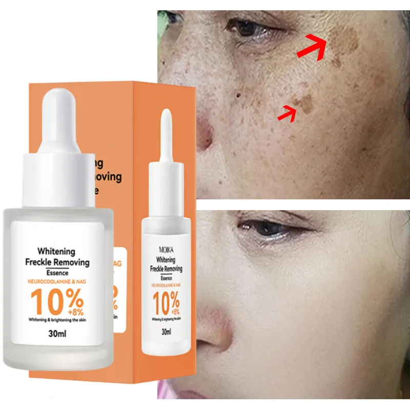 

30ML Brightening Serum For Face Dark Spot Freckle Remover Lighten Acne Mark Whitening Improve Dullness Moisturize Skin