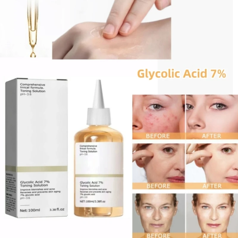 Glycolic Acid 7% Fruit Acid Toning Solution PH 3.6 Removing Acne Moisturizing Repairing Prevent Skin Aging Toner 100ml