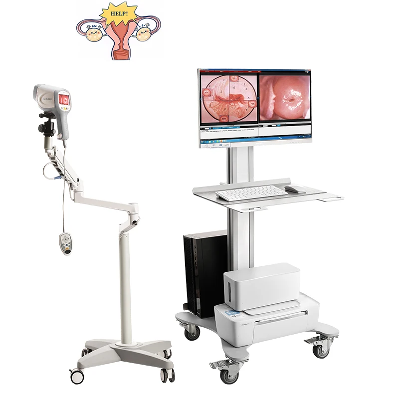 KN-2200A LED Cold Lighting System Handheld Video Digital Colposcope Gynecology Examination video Colposcopy for Clinic