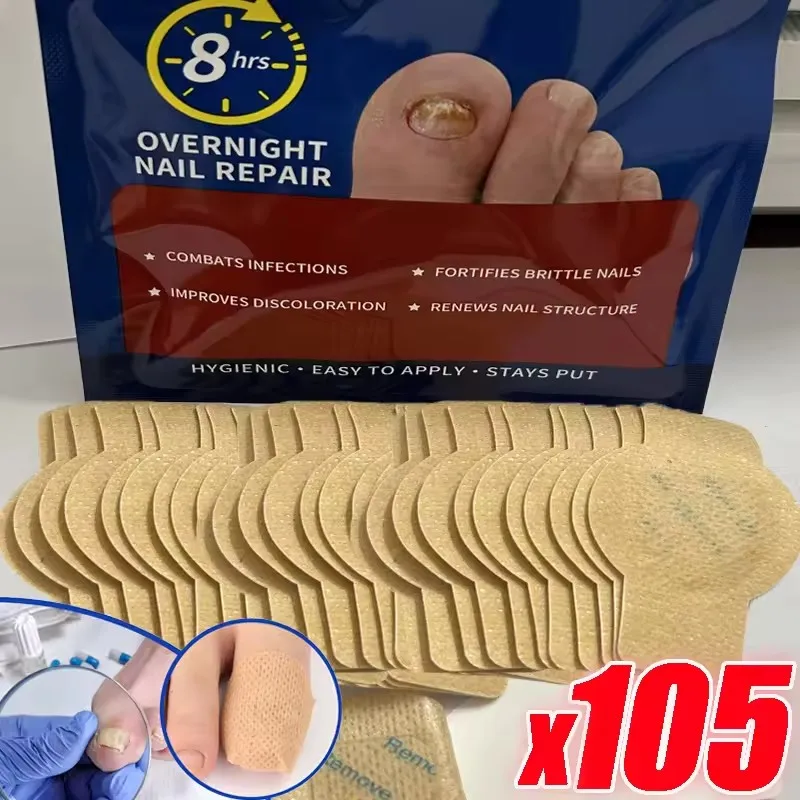 21/105pcs Nail Fungus Patch Waterproof Nail Repair Patch Ingrown Correction Sticker Damaged Nail Gray Care Patch Feet Care Tools